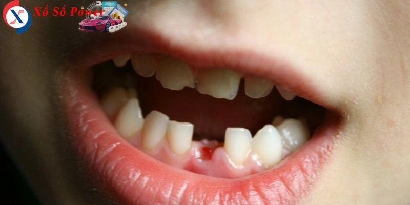 Biểu tượng của sự thay đổi hoặc mất mát trong tiềm thức