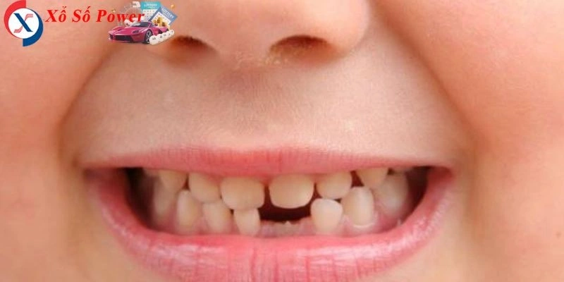 Hình ảnh răng rụng trong giấc mơ có thể liên quan đến sự sợ hãi hoặc lo lắng
